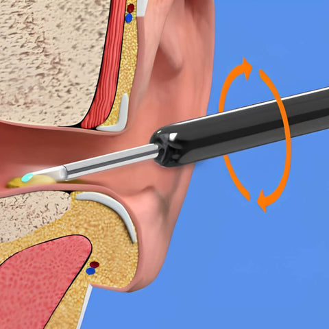 Wireless Ear Cleaner with Camera High Precision Ear Wax Removal Tool