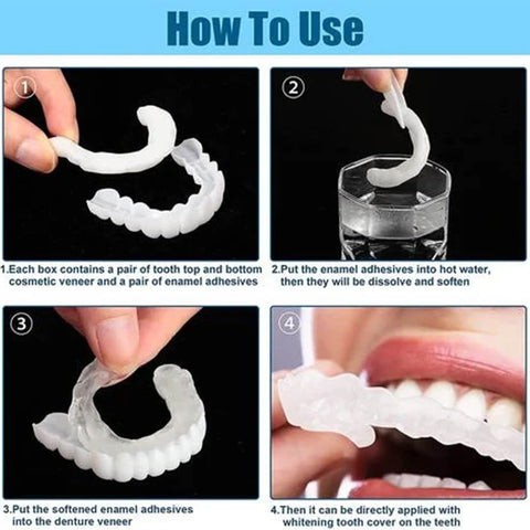 Adjustable Snap On Dentures