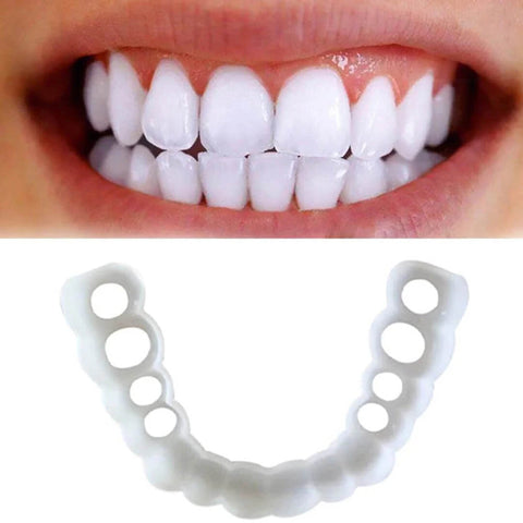 Adjustable Snap On Dentures
