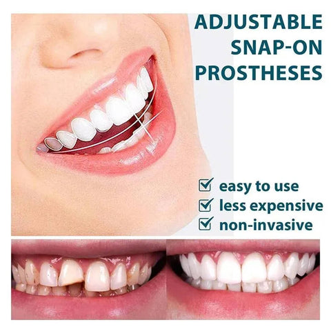 Adjustable Snap On Dentures