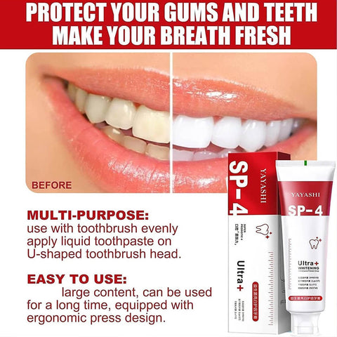 SP-4 Ultra White Probiotic Paste (120g)