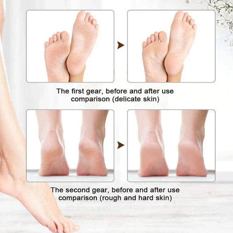USB Foot Grinding Machine