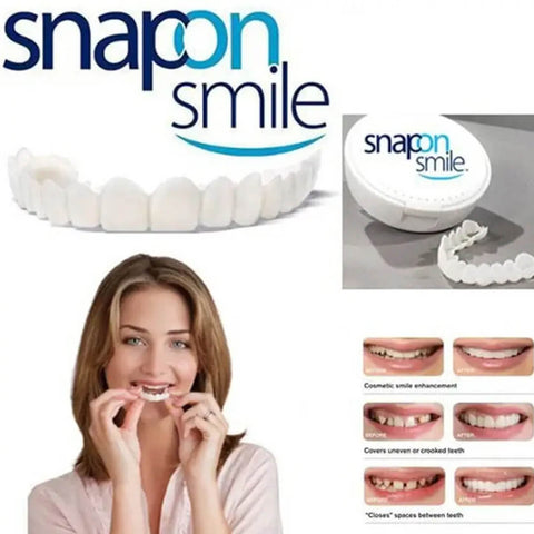 Adjustable Snap On Dentures