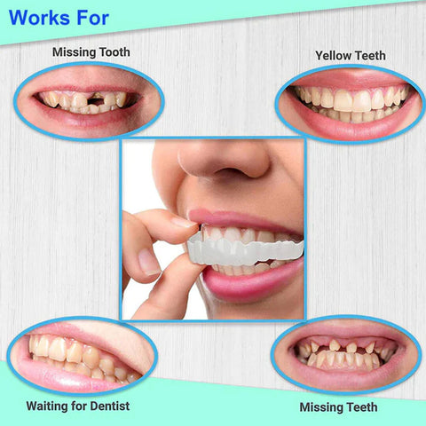 Adjustable Snap On Dentures