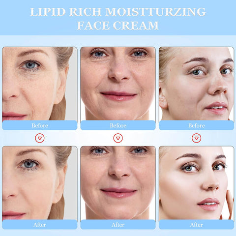 Salicylic Acid Ice Cream Mask