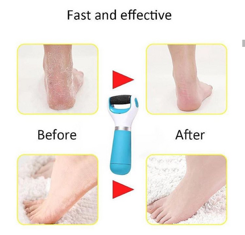Electric Foot File Dry Foot File